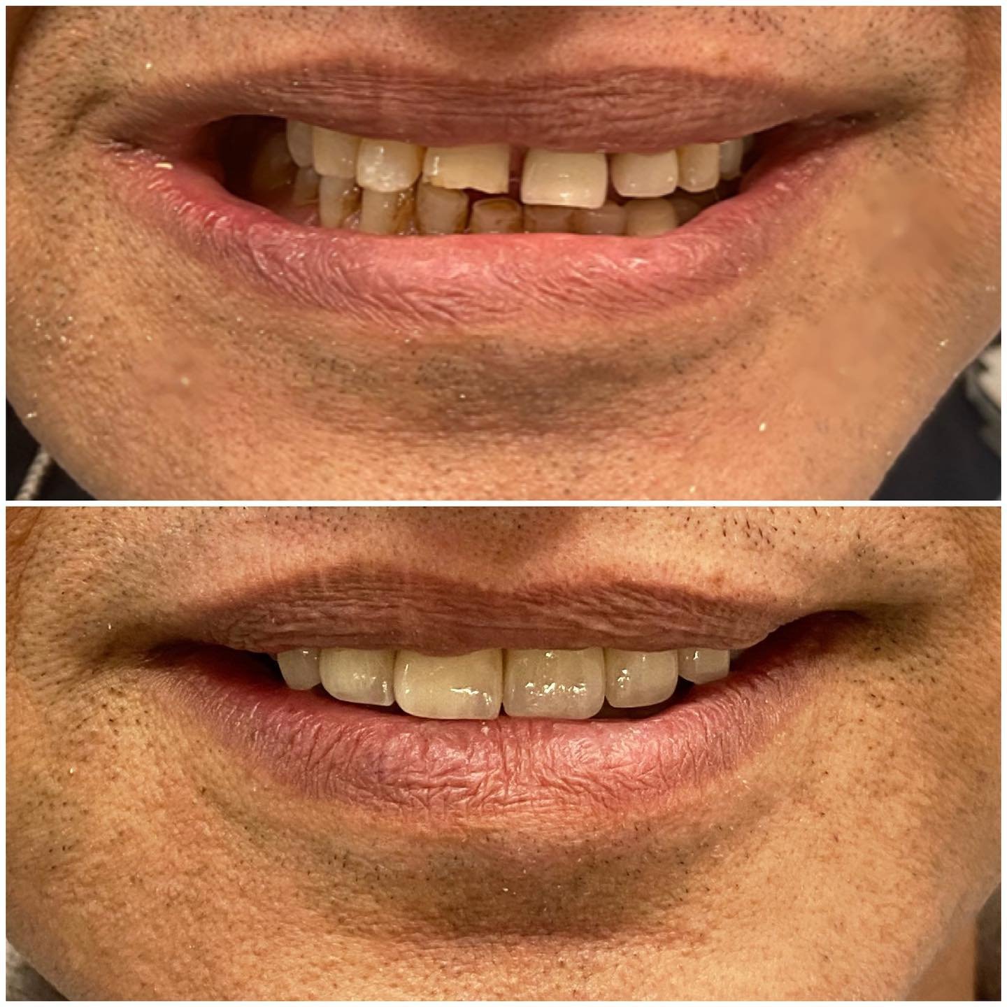 smile (1)