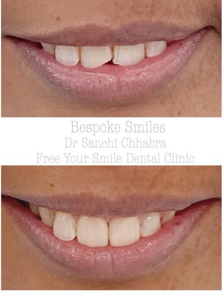 smile (1)