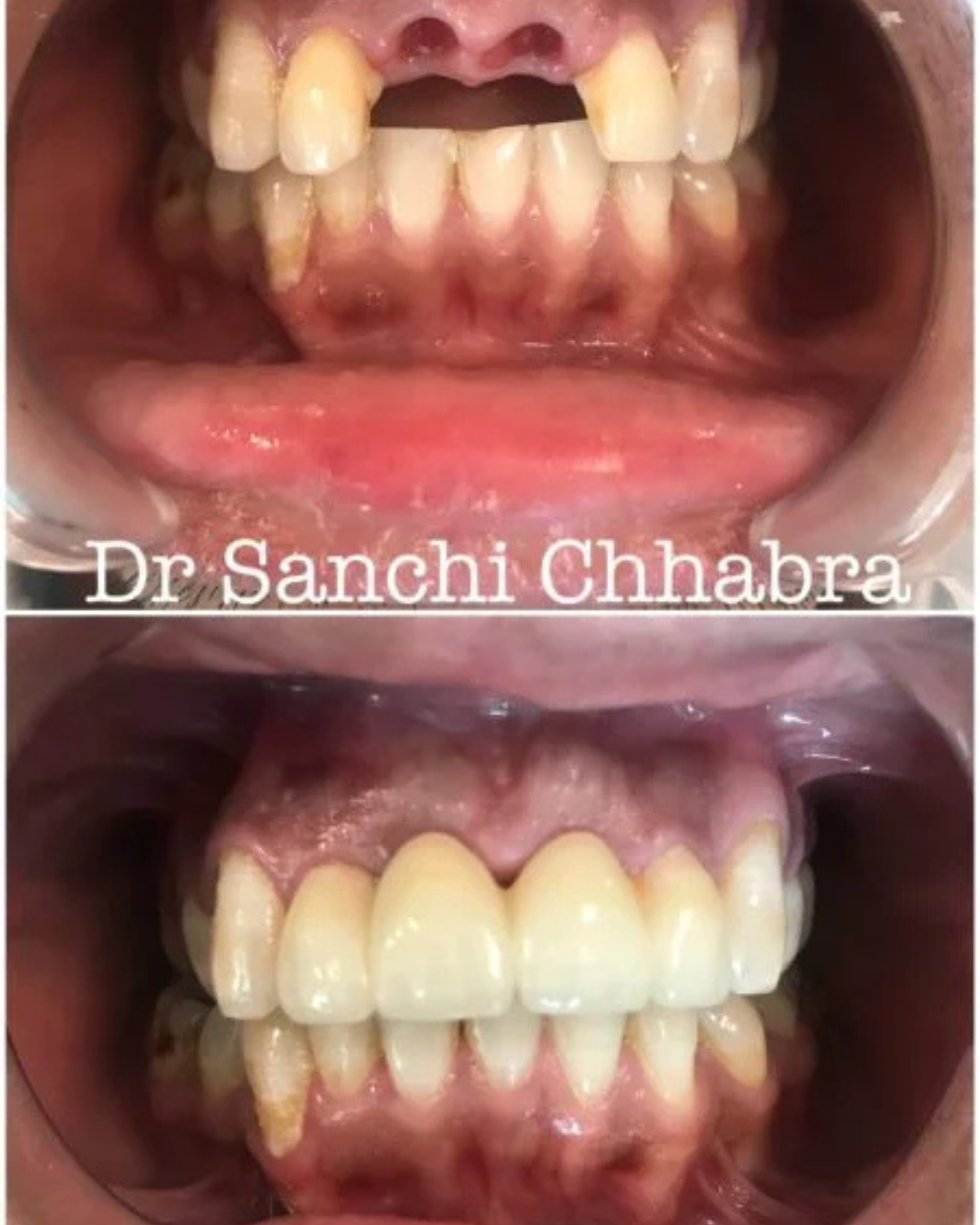 Smile Transformation 10