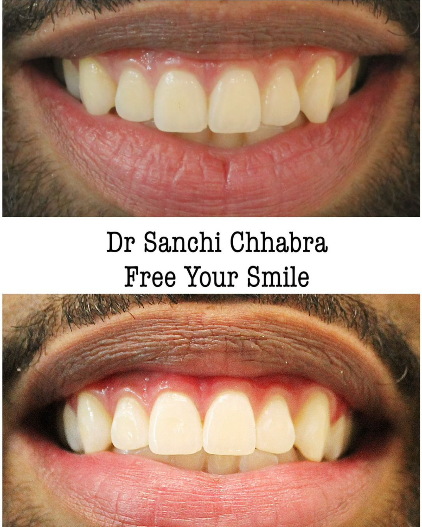 Smile Transformation 13