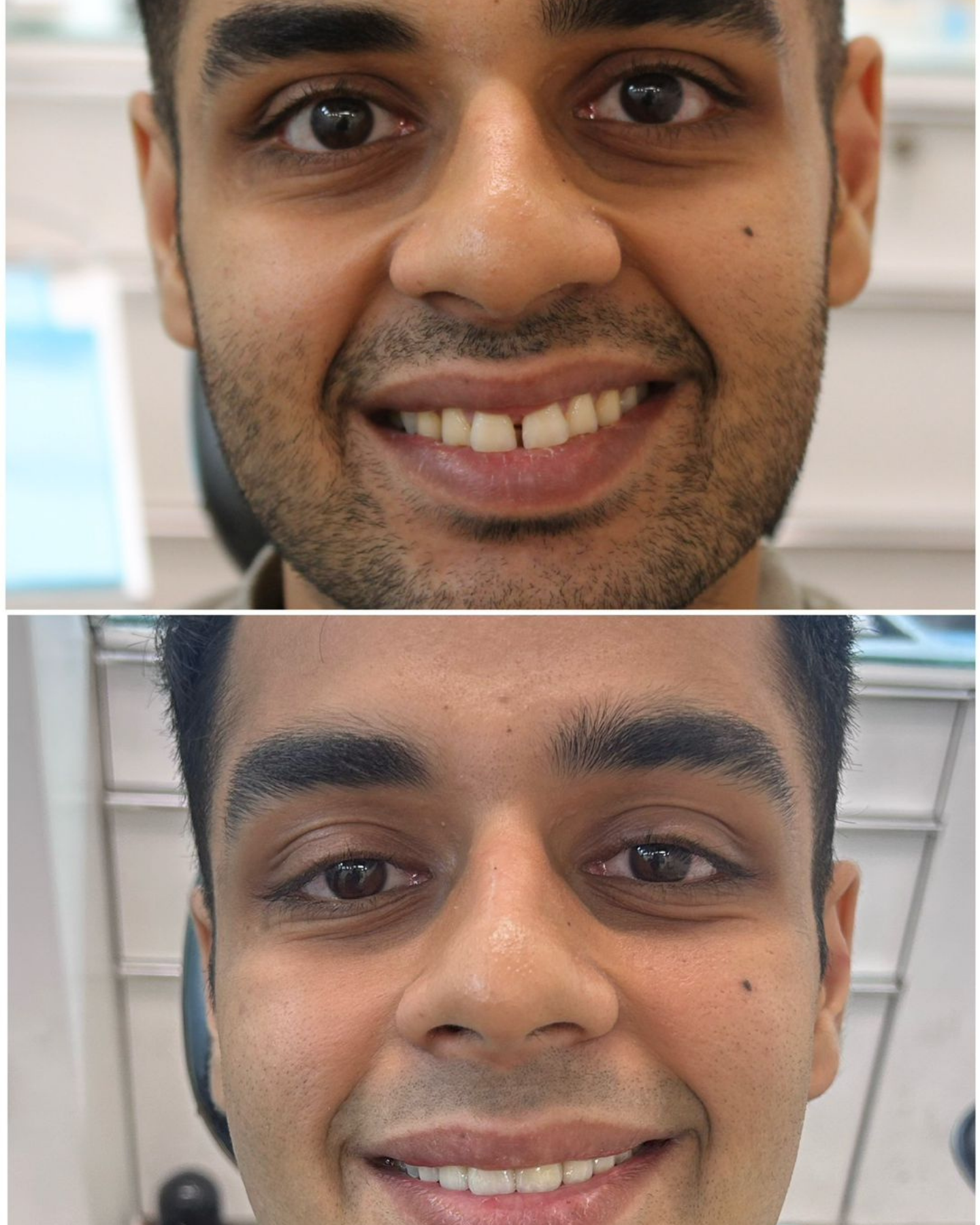 Smile Transformation 15