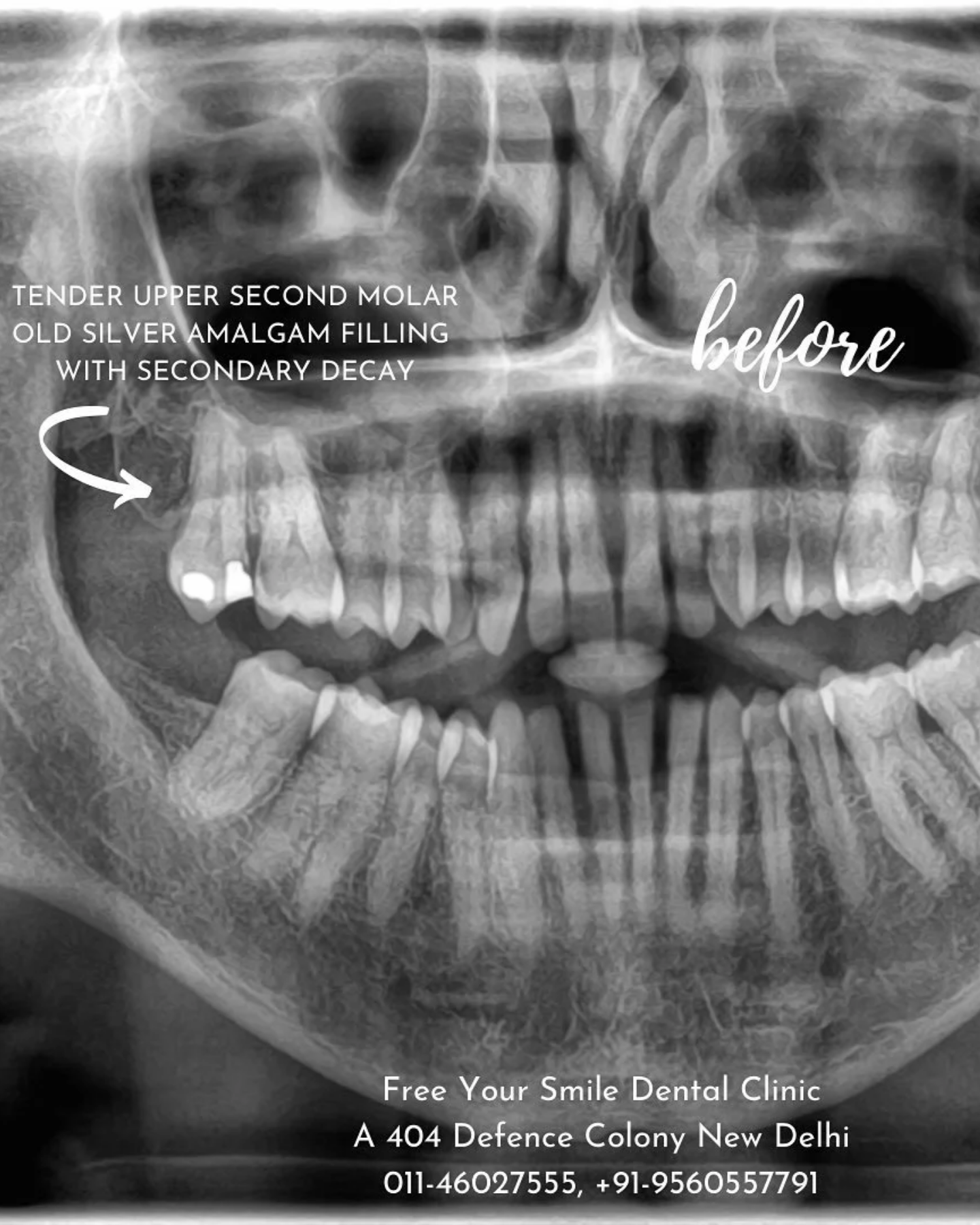 Smile Transformation 17