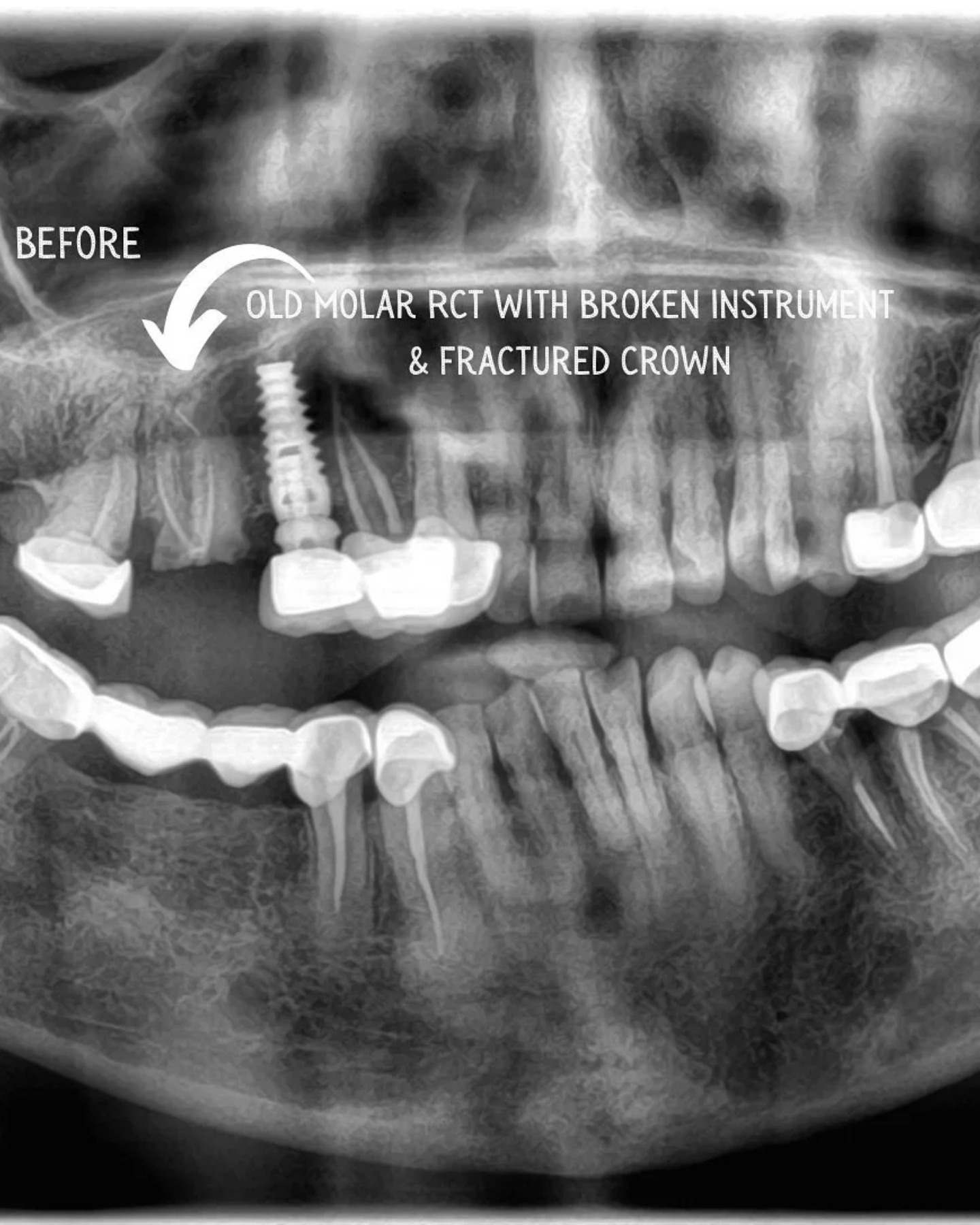 Smile Transformation 18