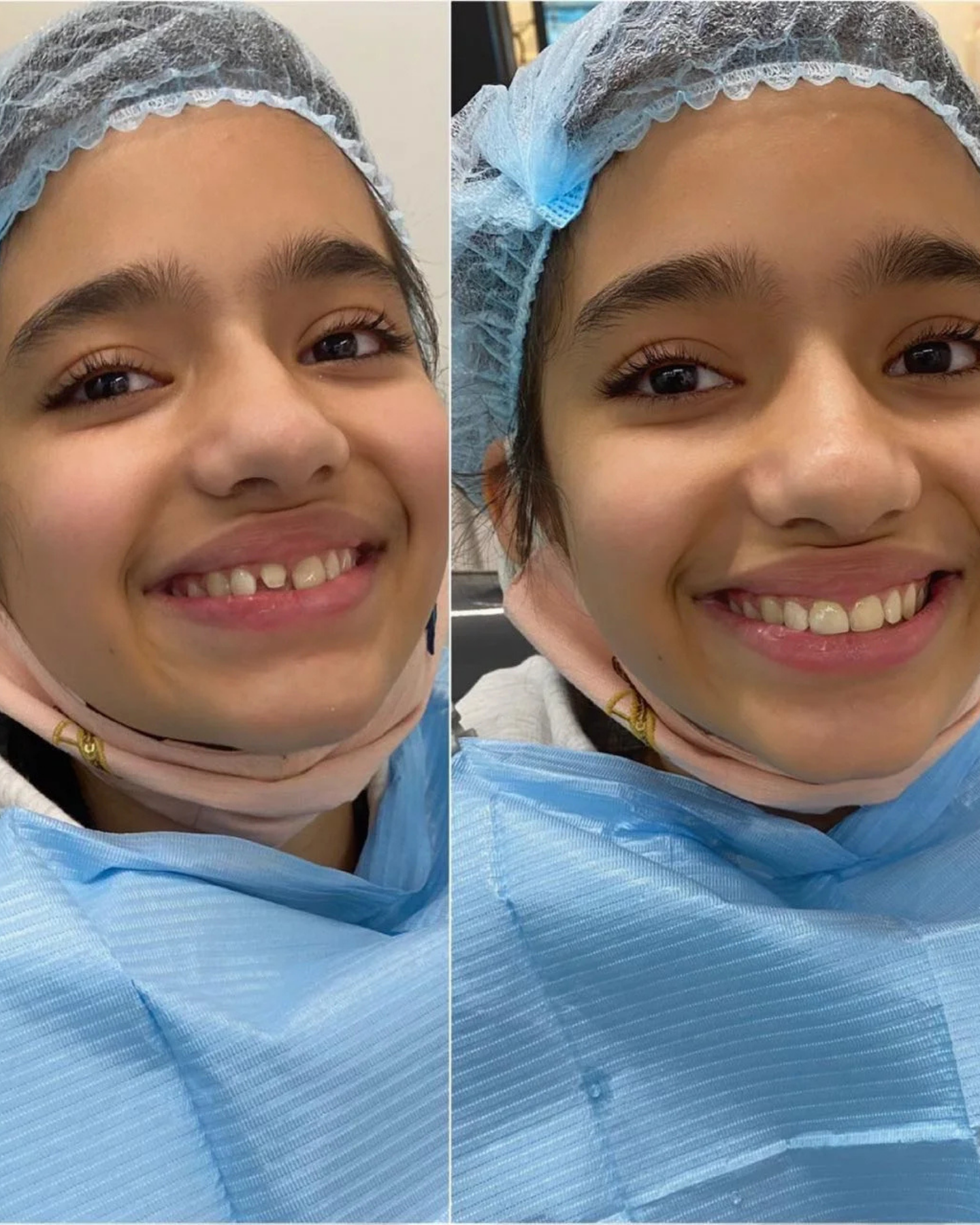 Smile Transformation 6