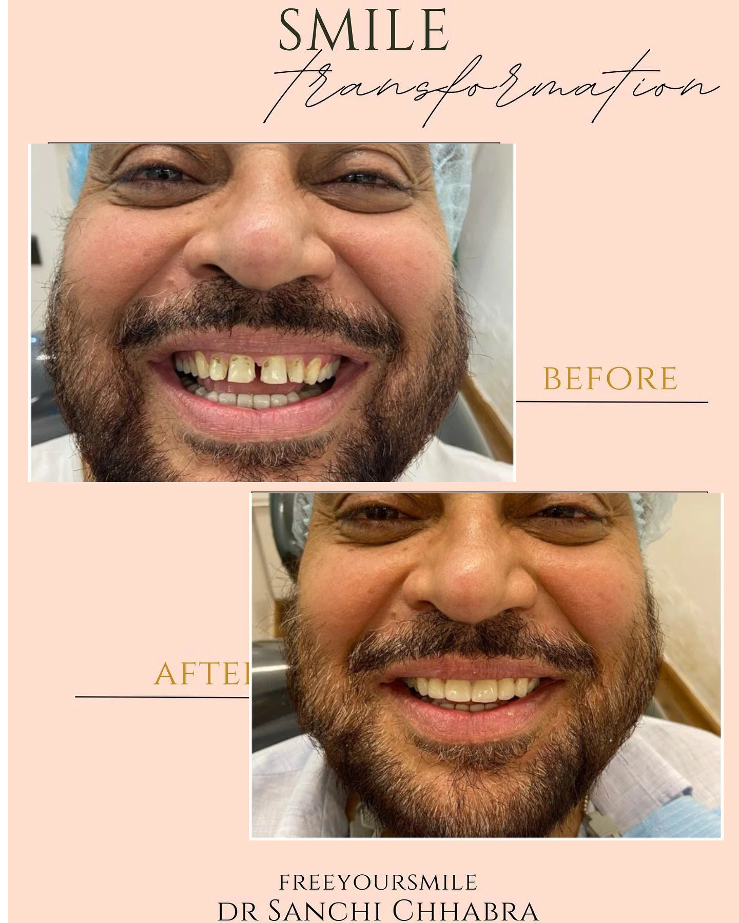 Smile Transformation 9